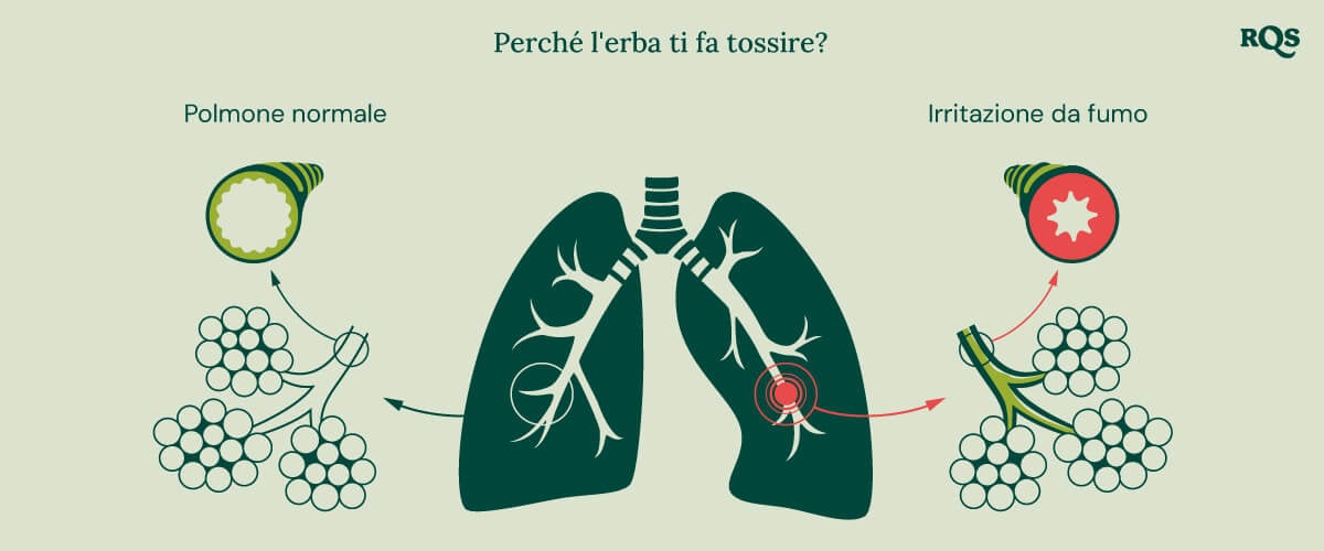 Diagramma del polmone sano rispetto al polmone irritato con infiammazione e bronchi gonfiati causati dal fumo di cannabis.