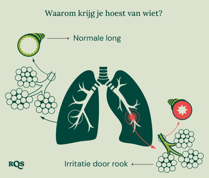 Diagramma del polmone sano rispetto al polmone irritato con infiammazione e bronchi gonfiati causati dal fumo di cannabis.